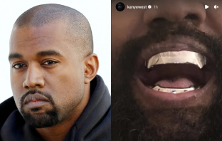 Kanye West file photo and his latest titanium teeth inspired from James Bond character Jaw