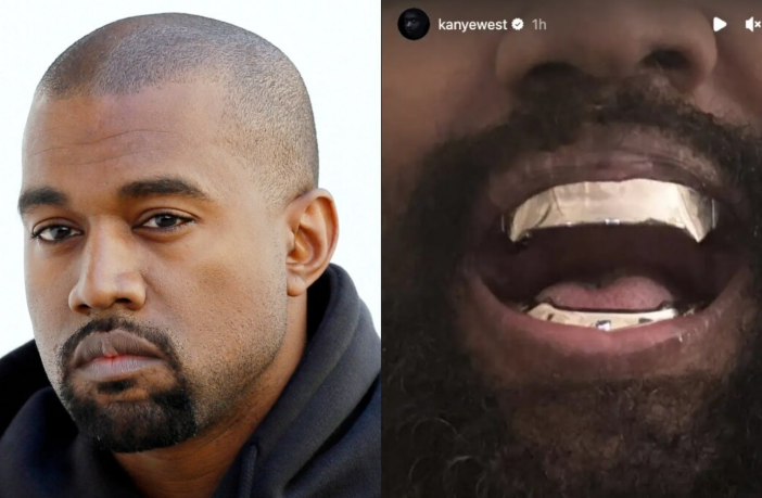 Kanye West file photo and his latest titanium teeth inspired from James Bond character Jaw